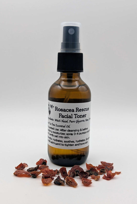 Rosacea Rescue Facial Toner
